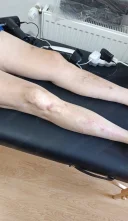 Kinetoterapie fizioterapie urziceni ialomita - imagine 1